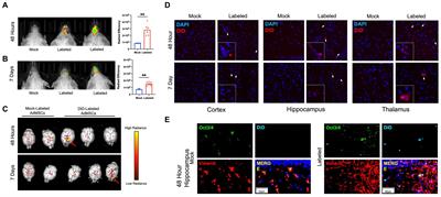 Intranasally delivered mesenchymal stromal cells decrease glial inflammation early in prion disease